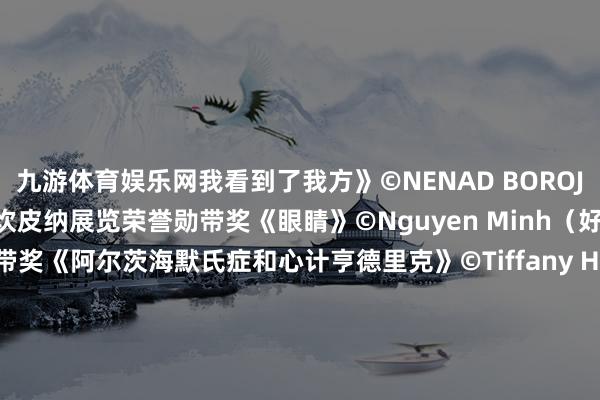 九游体育娱乐网我看到了我方》©NENAD BOROJEVIC（塞尔维亚）▲ 坎皮纳展览荣誉勋带奖《眼睛》©Nguyen Minh（好意思国）▲ ICS荣誉勋带奖《阿尔茨海默氏症和心计亨德里克》©Tiffany Heymans（比利时）▲ ICS荣誉勋带奖《加比》©TOMAS KOLISCH（巴西）▲ 坎皮纳展览荣誉勋带奖《鲁米欧》©KALYAN BHATTACHARYYA（印度）▲ 坎皮纳展览荣誉